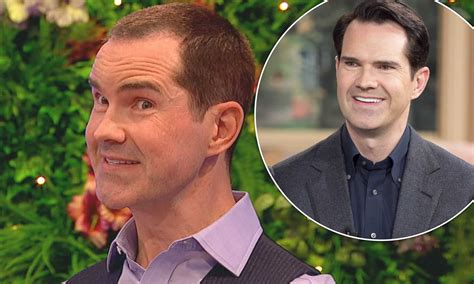 jimmy carr plastic surgery